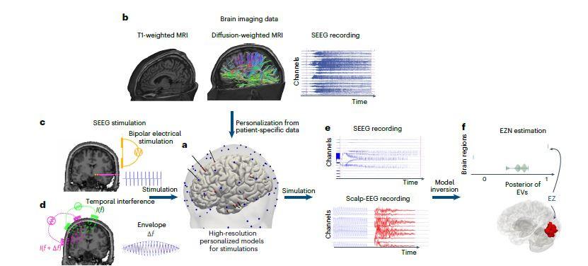 20250930 Vbt Stimulations For Epileplsy Cover