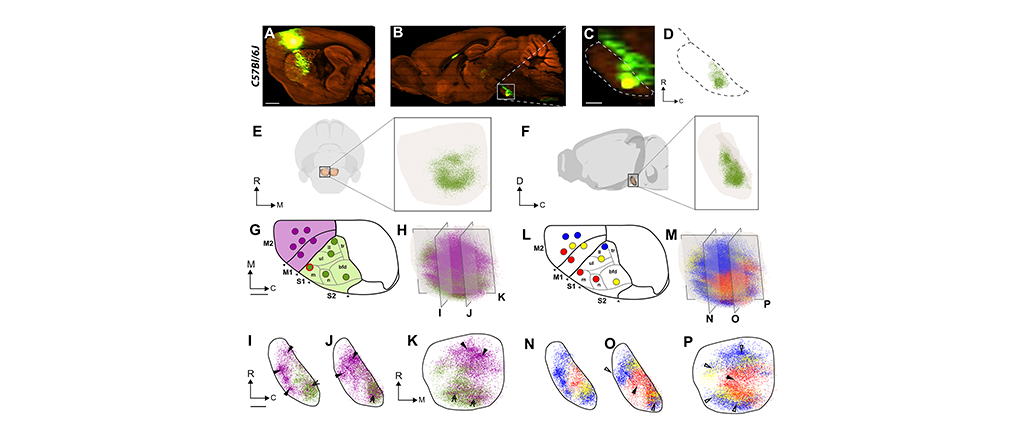 EBRAINS-enabled research provides new insight into abnormal brain development