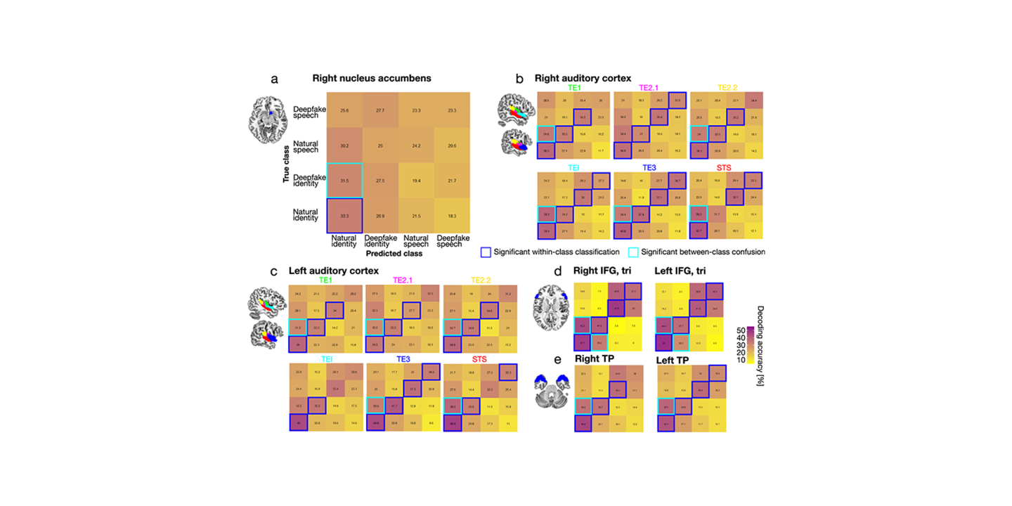 EBRAINS Atlas used in study