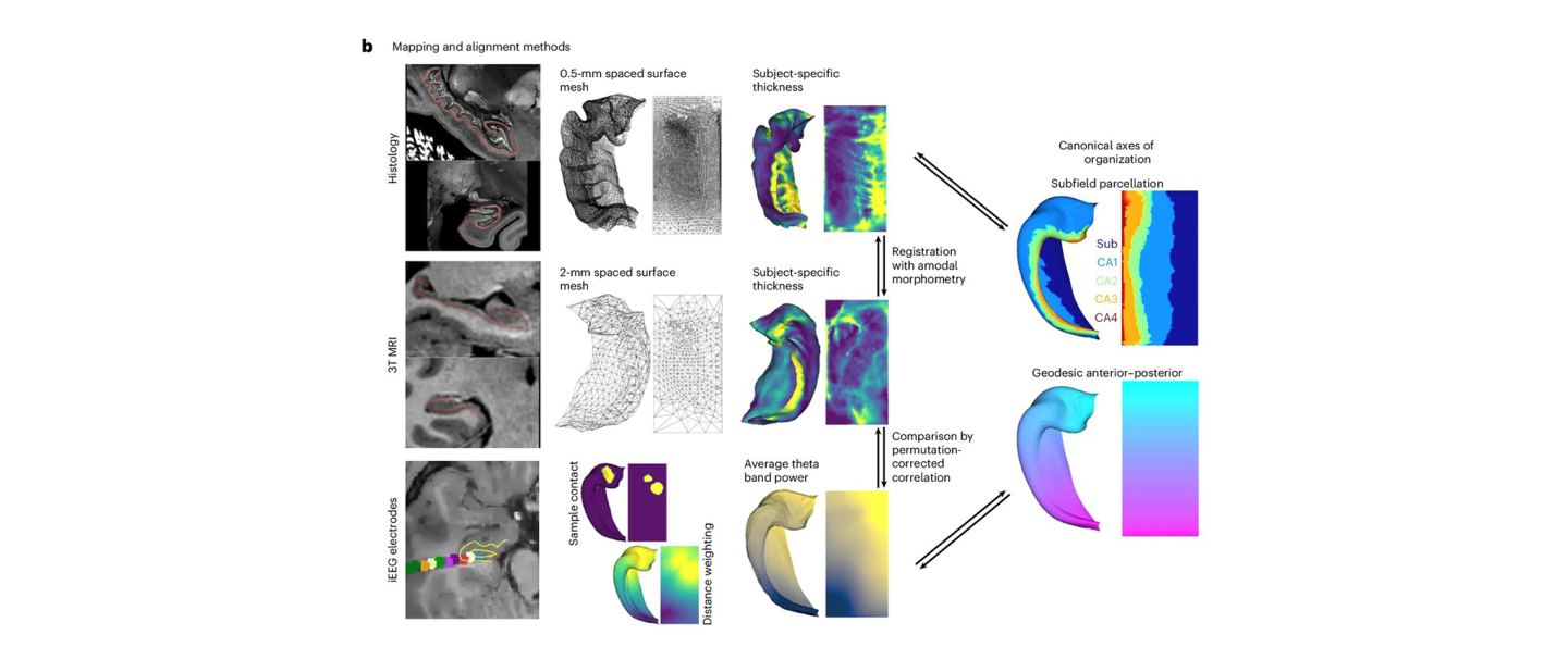 Hippomaps Simplifies Hippocampus Research Image
