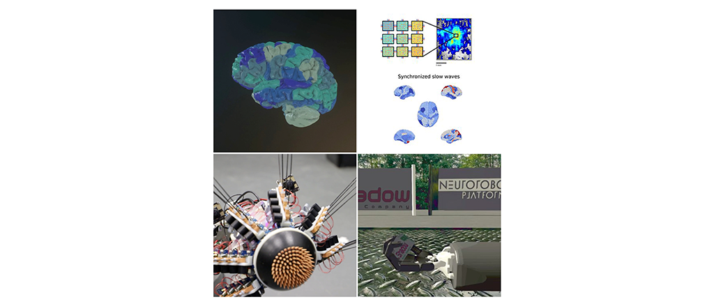 How Scientists Are Using EBRAINS