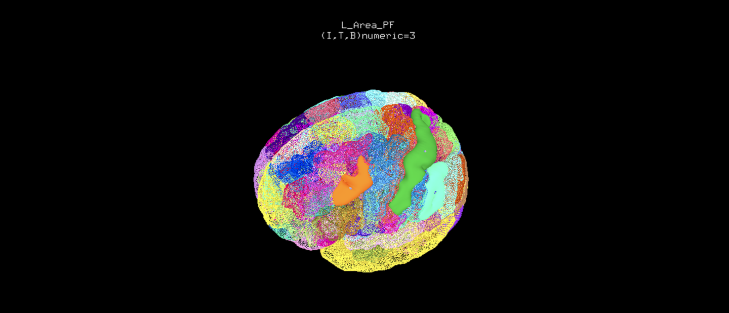 Julich Brain Atlas Becomes New Default Atlas In Afni Image