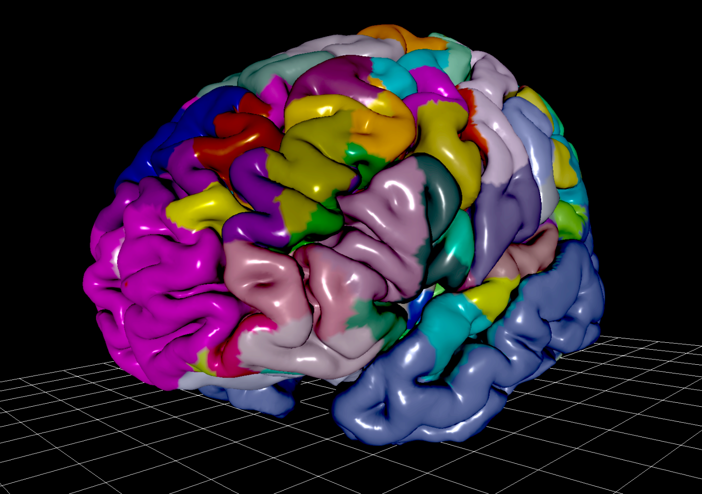 Image of the Julich Brain Atlas