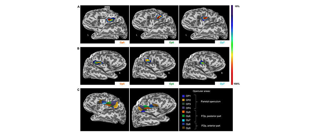 Three Newly Identified Brain Areas Involved In Sexual Sensation Motor Coordination And Music Processing Available On Ebrains Image