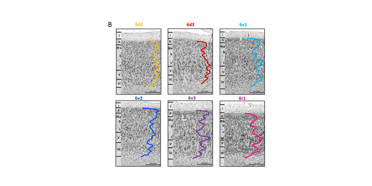 With New Brain Maps The Eye Fields Can Be Located More Precisely