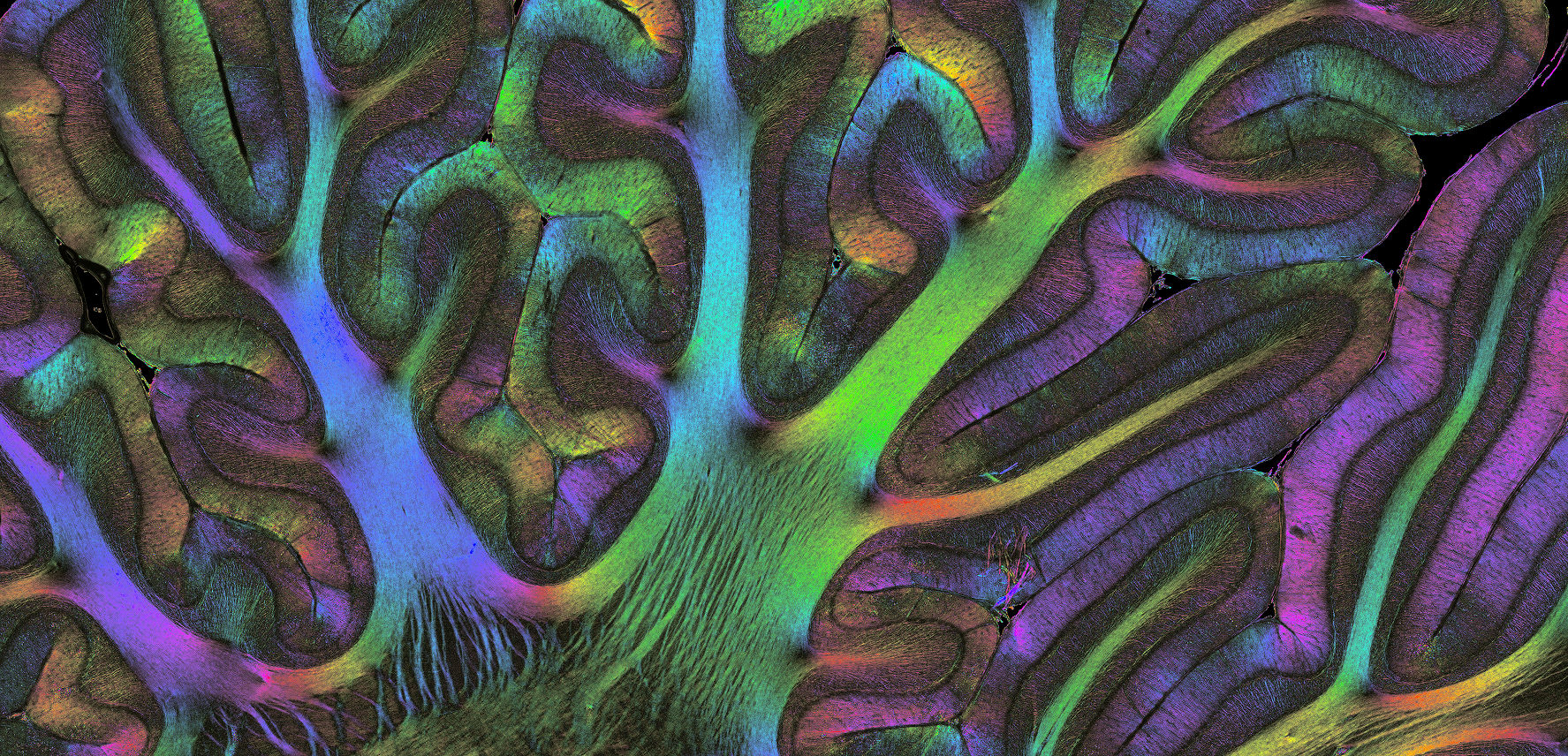 Brain fibers visualized with polarized light imaging