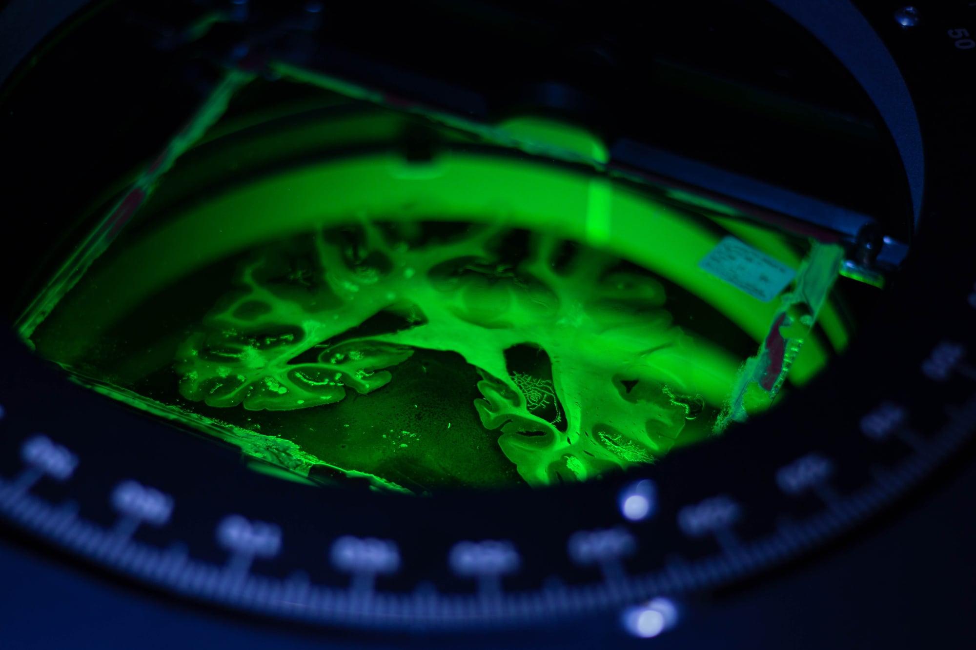 Brain under Microscope