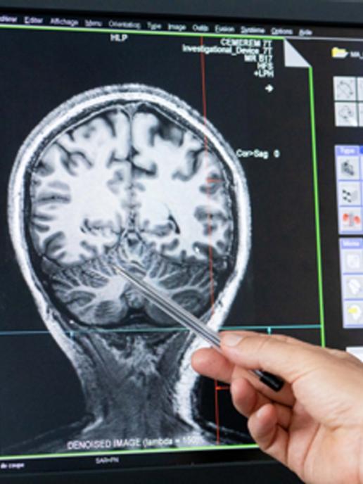 Screen showing an MRI scan