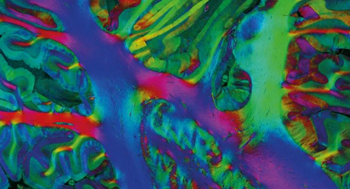 Brain fibers visualized with polarized light imaging