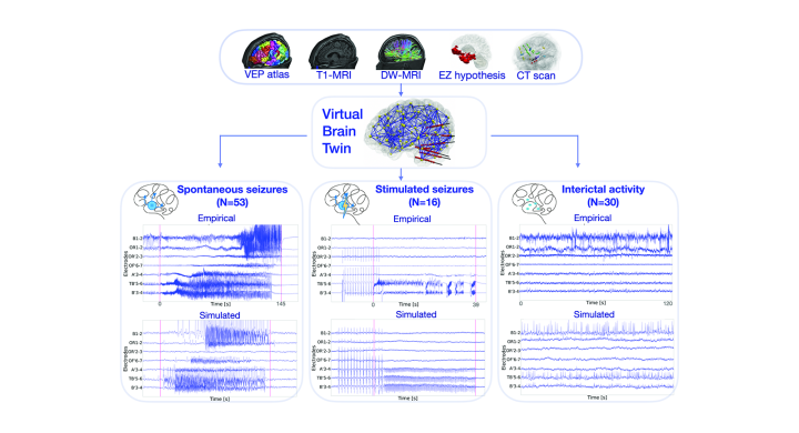 Workflow of the virtual epileptic cohort