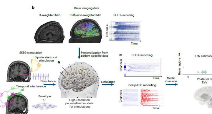 20250930 Vbt Stimulations For Epileplsy Cover