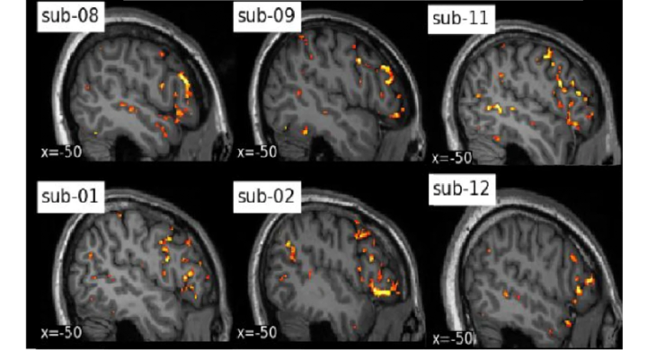 Teaser image for Individual Brain Charting: new high-resolution fMRI data for cognitive mapping