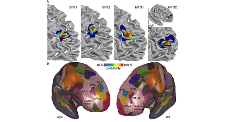 EBRAINS Brain Atlas enables scientists to map four new brain regions involved in many cognitive processes
