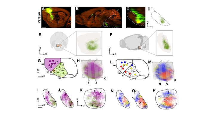 EBRAINS-enabled research provides new insight into abnormal brain development