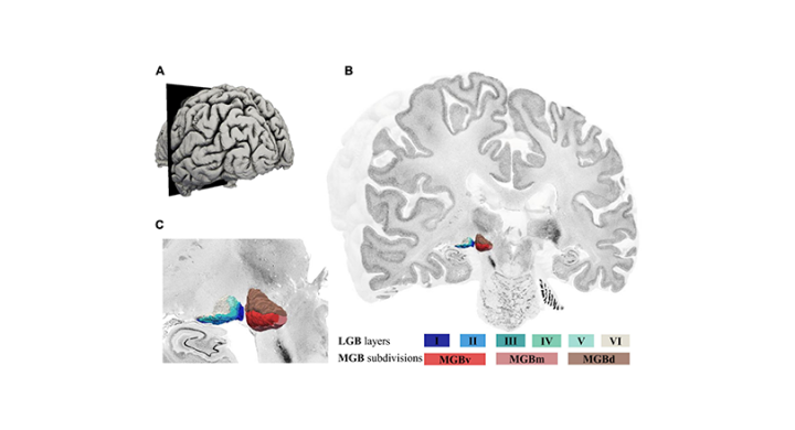 EBRAINS provides access to new high-resolution cytoarchitectonic 3D map of the metathalamus