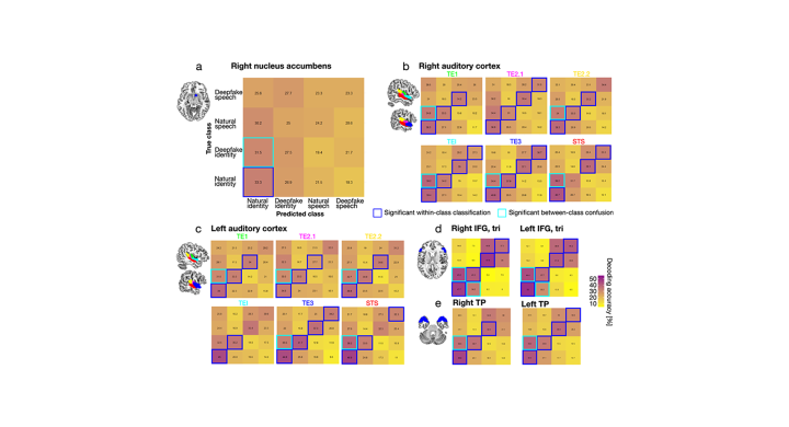 EBRAINS Atlas used in study