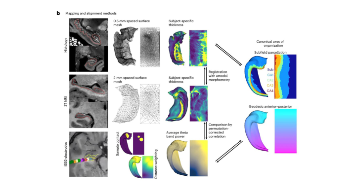 Hippomaps Simplifies Hippocampus Research Image