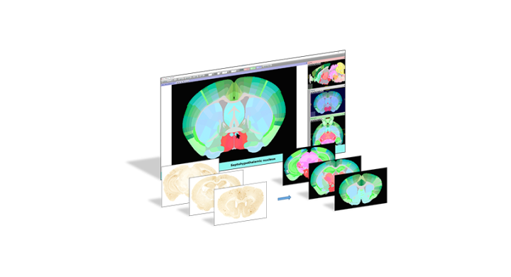 New Unified Mouse atlas from the KIM lab is now available in the EBRAINS QuickNII image registration tool