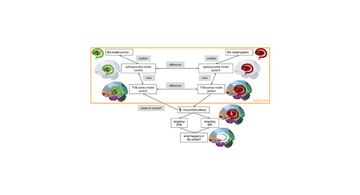 Scientists use EBRAINS to simulate deep brain stimulation in Parkinson’s disease