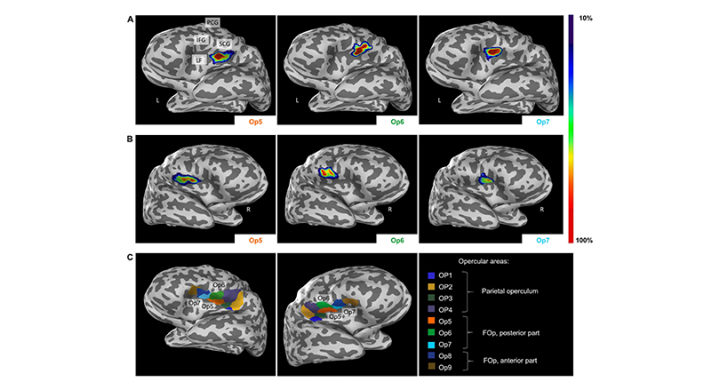 Three Newly Identified Brain Areas Involved In Sexual Sensation Motor Coordination And Music Processing Available On Ebrains Image