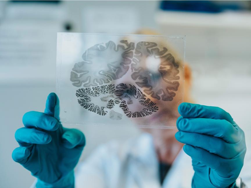 Female scientist holding a brain section mounted on a glass plate
