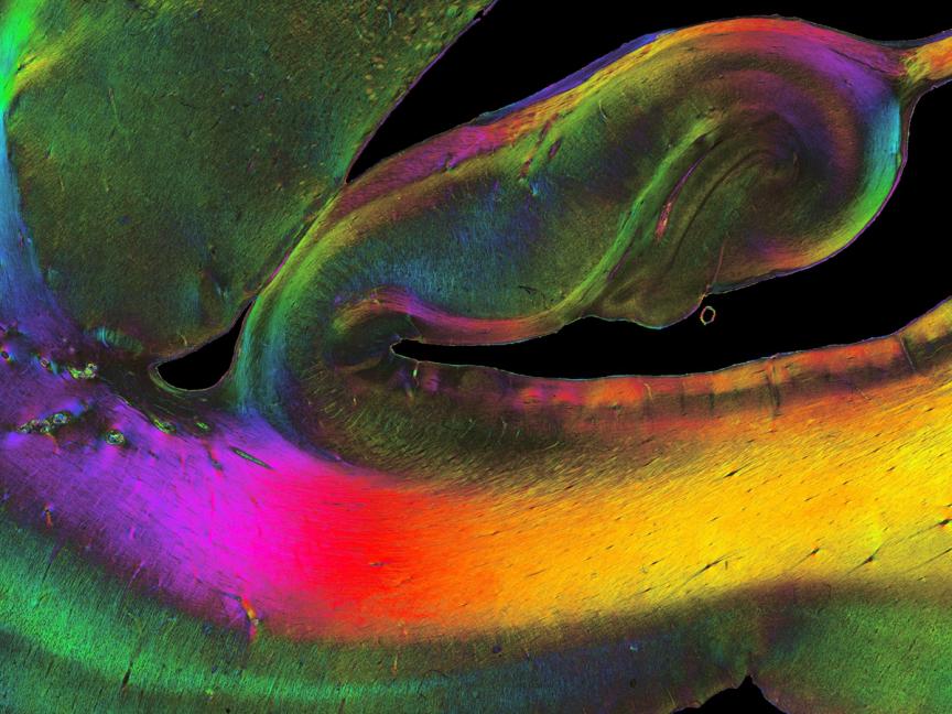 Nerve fibres visualized by polarized light imaging