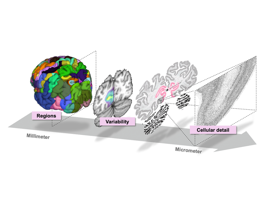From a probabilistic brain map to individual cell bodies in the BigBrain