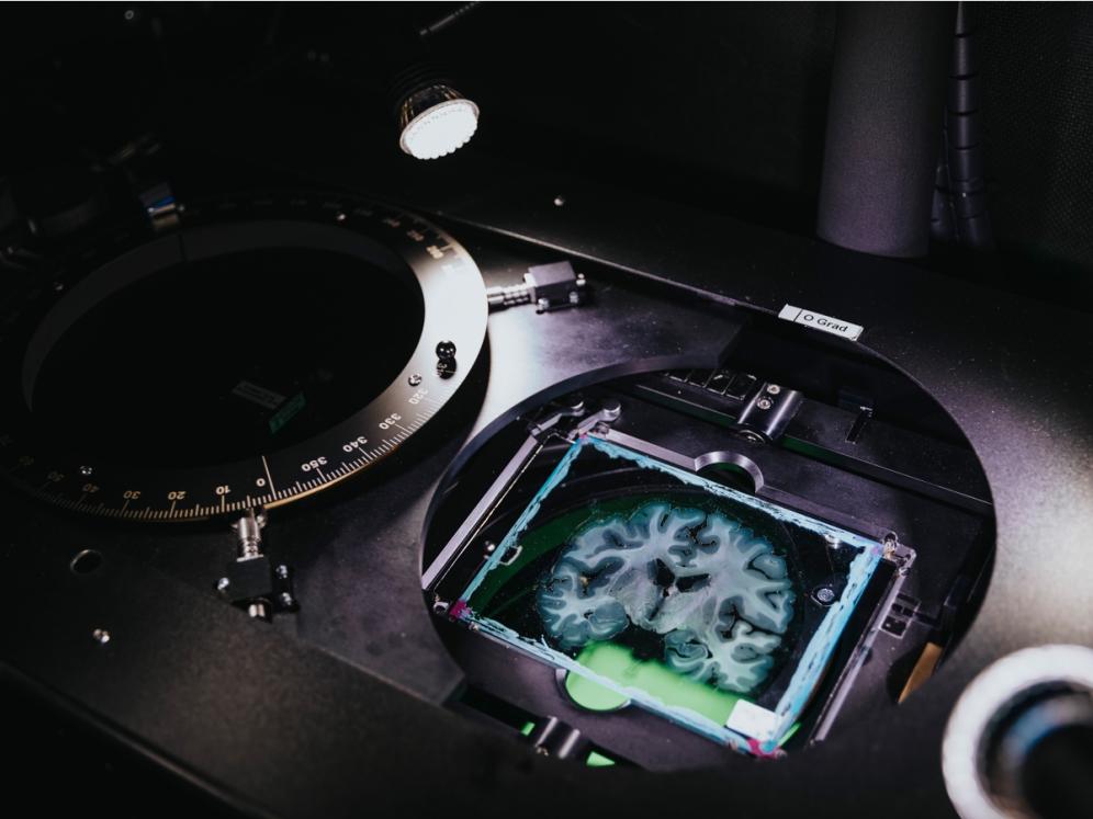 Brain fibre measurement