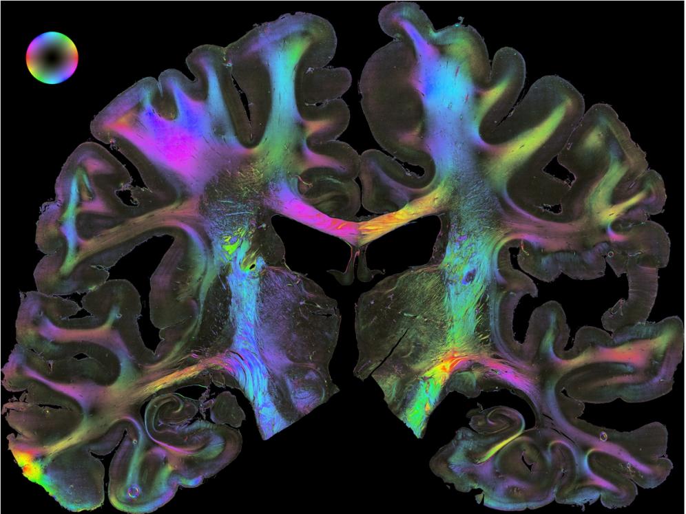 Fibre Orientation Map