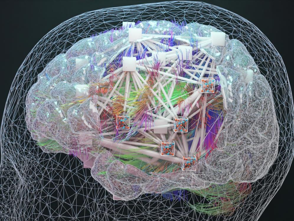 Illustration of the multiple-scales network of a human brain