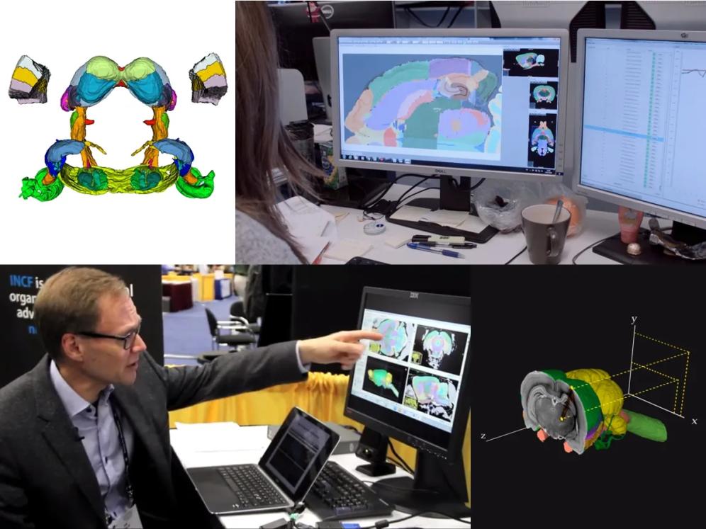 Work around the rat brain atlas