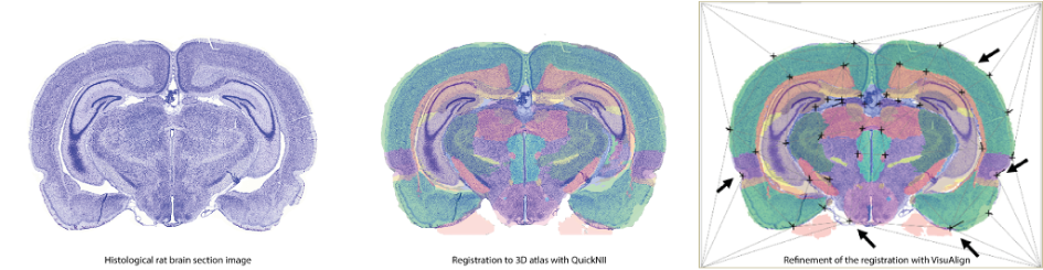 2D section images to 3D atlas