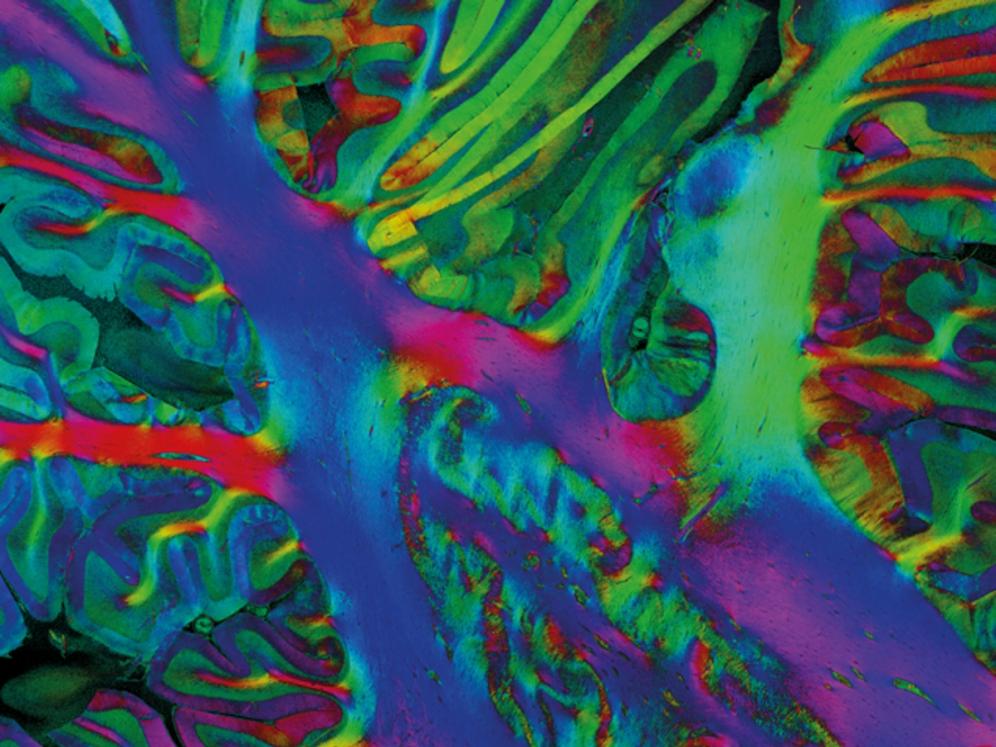 Brain fibers visualized with polarized light imaging