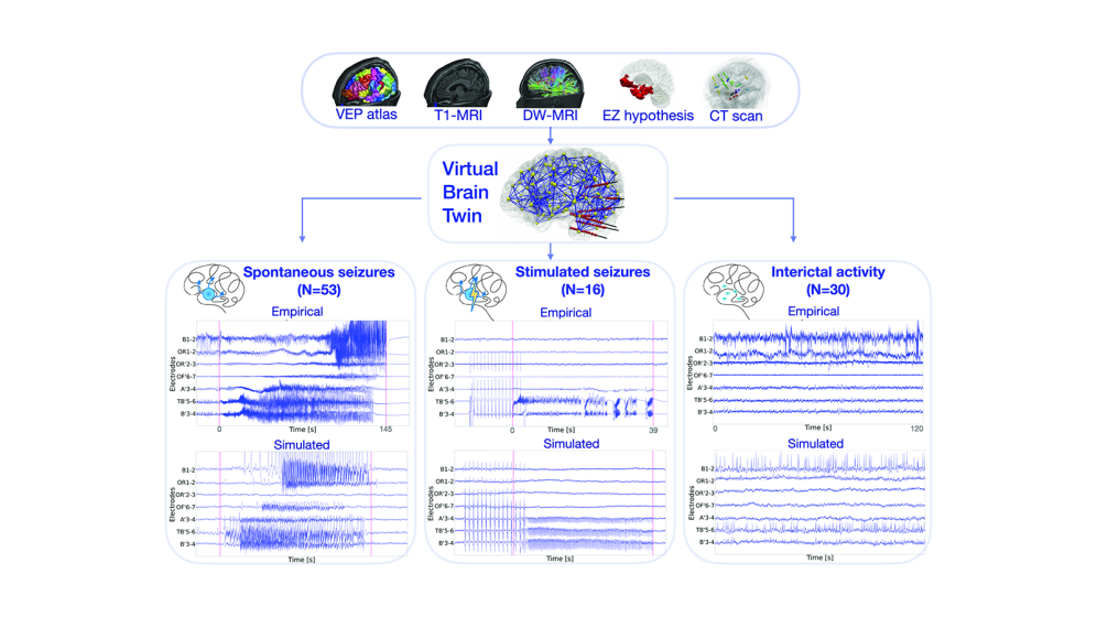 Workflow of the virtual epileptic cohort
