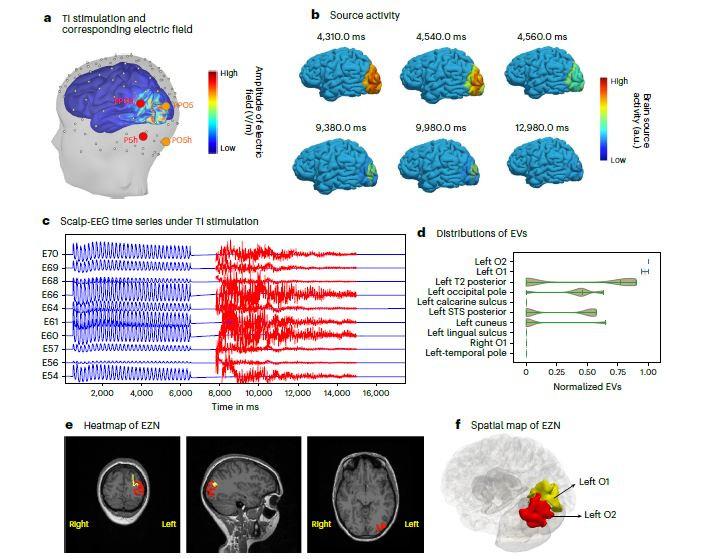 20250930 - TI Stimulation