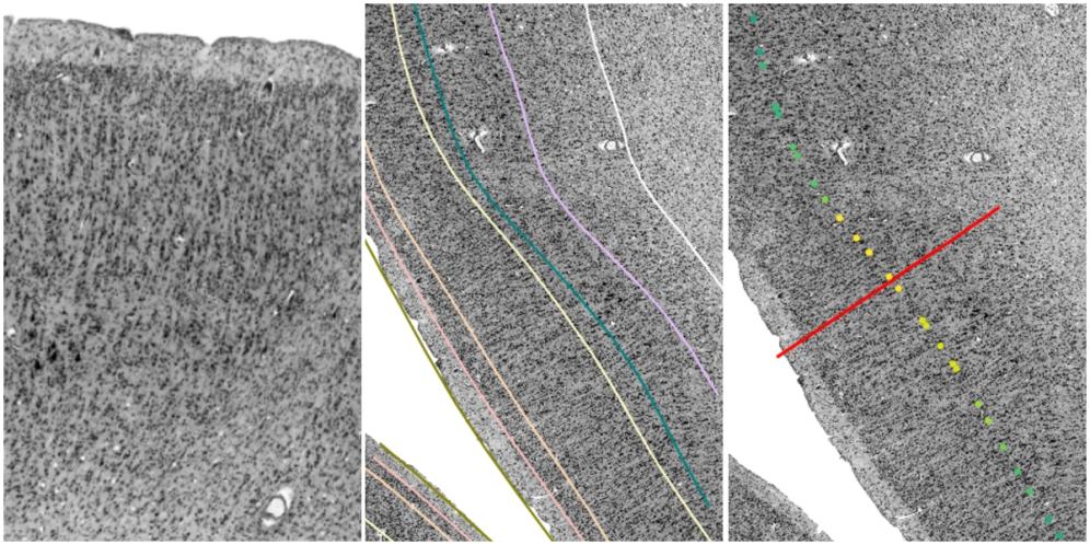 A) Image patch chosen by siibra. B) Layer surfaces projected onto the image patch. C) Cortical profile defined by the projected layer surfaces.