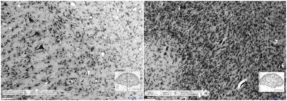 The same staining, two cortical types: Regions of interest in the motor (left) and visual cortex (right)