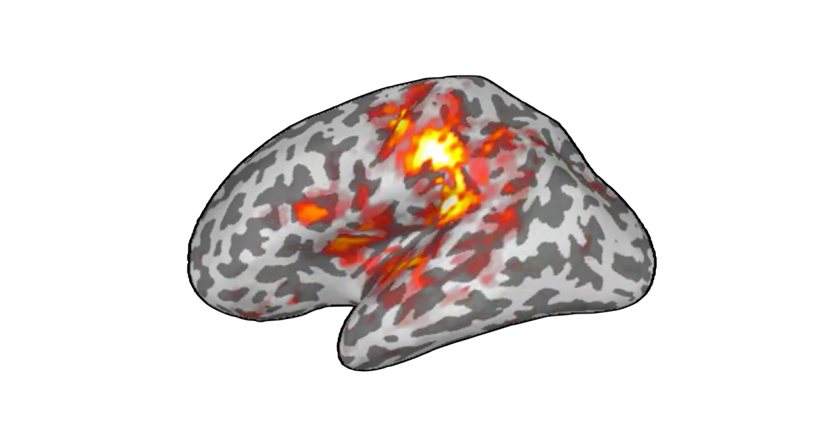MEG signals help predict symptom progression in Parkinson’s disease, new study shows