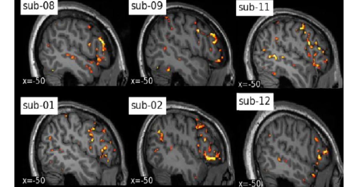Individual Brain Charting: new high-resolution fMRI data for cognitive mapping