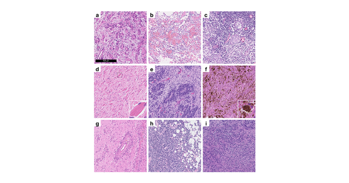Training medical AI models with the Digital Brain Tumour Atlas on ...